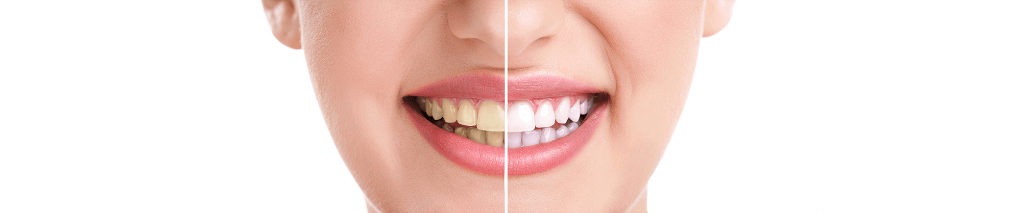 Cosmetic Dentistry in Humble, Texas
