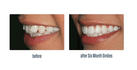 Before Dental Procedure