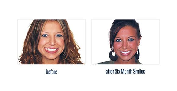 Before Dental Procedure