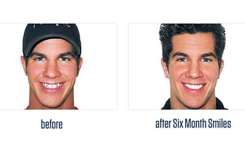 Before Dental Procedure