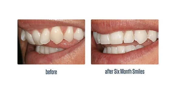 Before Dental Procedure