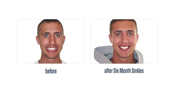 Before Dental Procedure