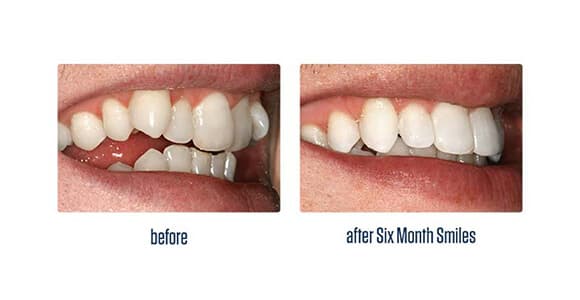 Before Dental Procedure