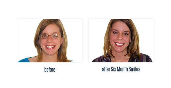 Before Dental Procedure