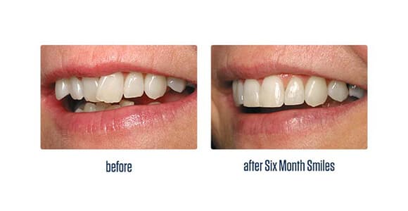 Before Dental Procedure
