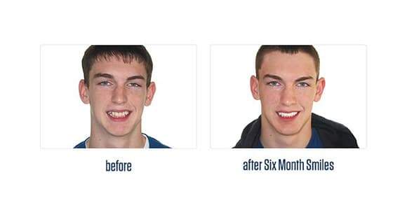 Before Dental Procedure